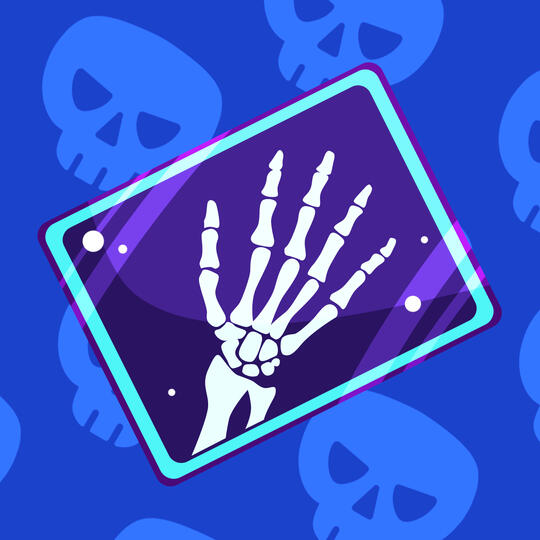 X-Ray X-Ray